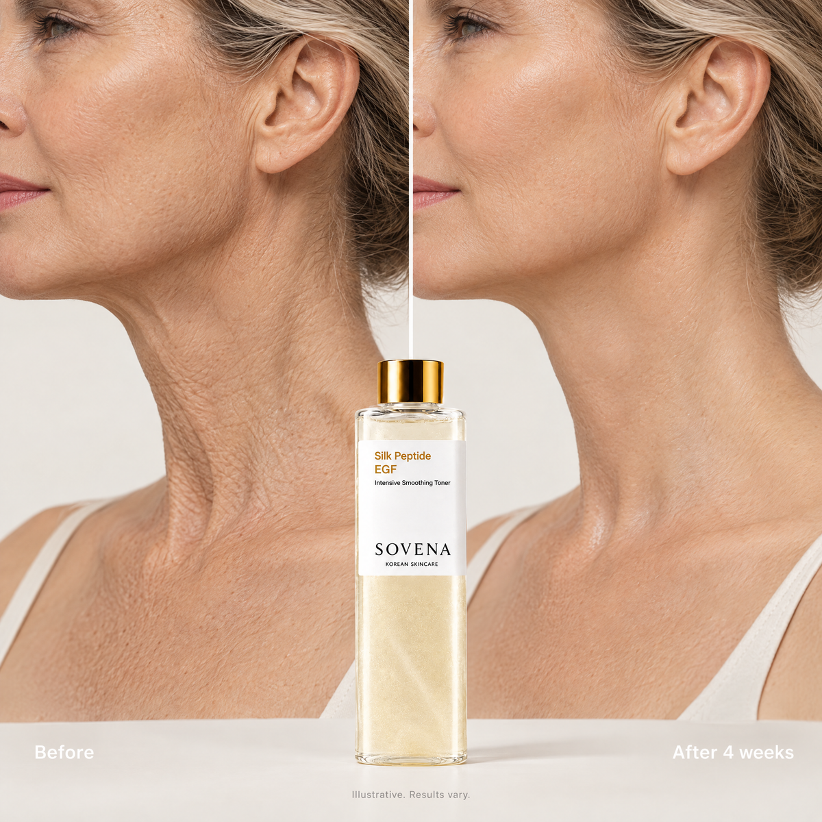 Neck before and after